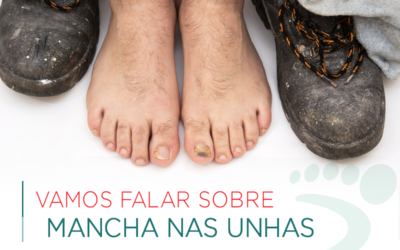 Vamos falar sobre mancha nas Unhas?