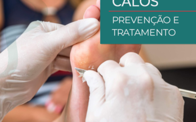 Calos – Tratamento e Prevenção