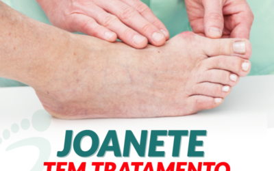 Joanete tem tratamento