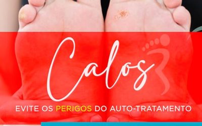 Calos e o perigo do auto-tratamento.