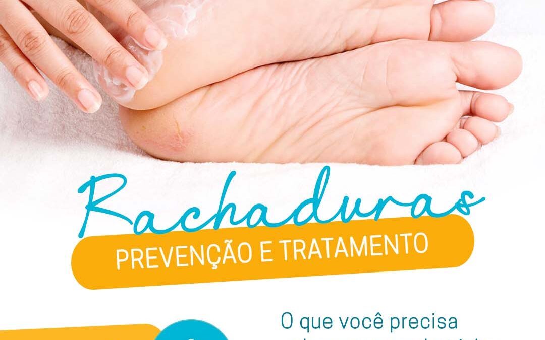 RACHADURAS – TRATAMENTO E PREVENÇÃO